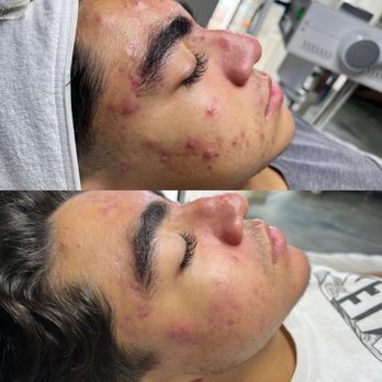 Skin By Britney - Skin Care Near Me - Cypress, California Skin By Britney - Skin Care Near Me - Cypress, California