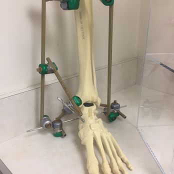 Curalta Foot & Ankle - Ridgewood - Looks like it hurt... - Podiatrists Near Me - Ridgewood, New Jersey