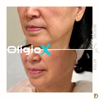 Dawoom Clinic - Oligio X - Medical Spas Near Me - Los Angeles, California Dawoom Clinic - Oligio X - Medical Spas Near Me - Los Angeles, California