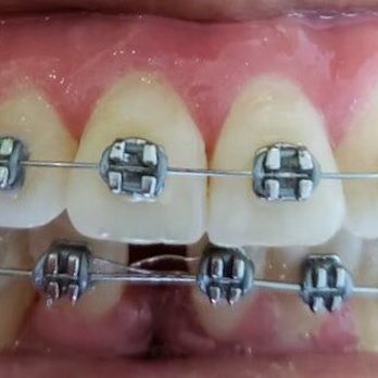 Moe Yazdi, DDS, PhD - Orthodontists Near Me Moe Yazdi, DDS, PhD - Orthodontists Near Me