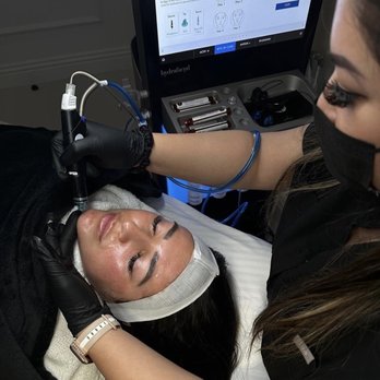 Glow Up Med Spa - Hydra facial must try - Medical Spas Near Me - Cypress, California Glow Up Med Spa - Hydra facial must try - Medical Spas Near Me - Cypress, California