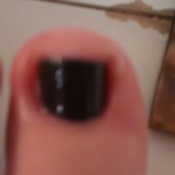 7 Day Spa & Nails - I can barely walk because my toe is so infected. - Nail Salons Near Me - Tempe, Arizona 7 Day Spa & Nails - I can barely walk because my toe is so infected. - Nail Salons Near Me - Tempe, Arizona