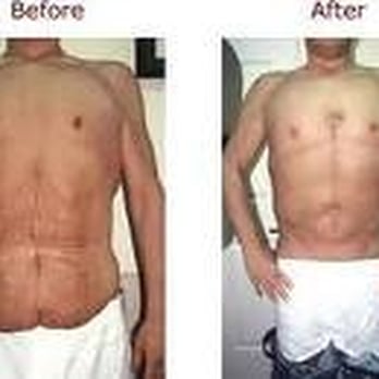 Weight Loss In Riverside - weight loss in Riverside Local area. - Weight Loss Centers Near Me - Riverside, California Weight Loss In Riverside - weight loss in Riverside Local area. - Weight Loss Centers Near Me - Riverside, California