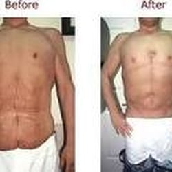 Weight Loss In Riverside - Weight loss in Riverside Local area.