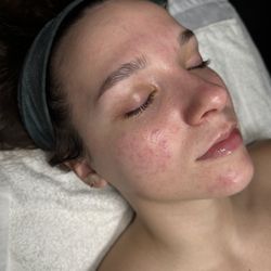 Esthetique Plus