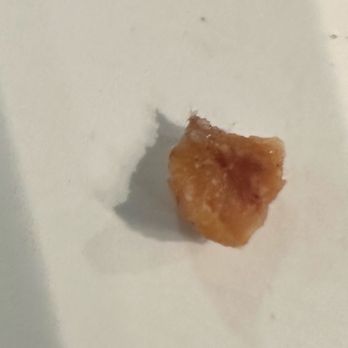House of JuJu - In my turkey burger. Bone? Small chip in tooth - Bars Near Me - Clovis, California House of JuJu - In my turkey burger. Bone? Small chip in tooth - Bars Near Me - Clovis, California