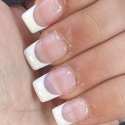 Cuticles were destroyed