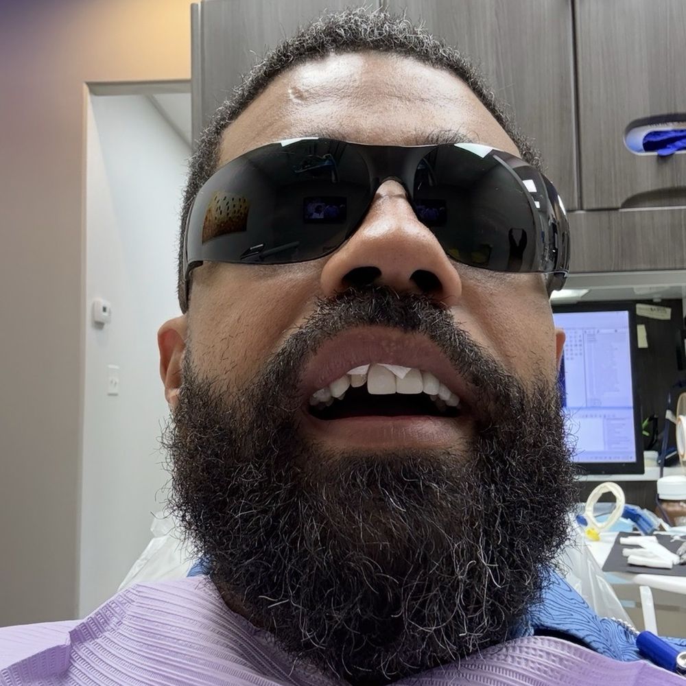 Smile Texas - lost a tooth - Cosmetic Dentists Near Me - Sugar Land, Texas