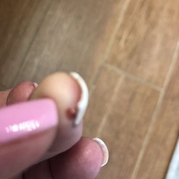Love Nails - Middle finger cut - you can see a big cut by my nail. - Nail Technicians Near Me - Chino, California