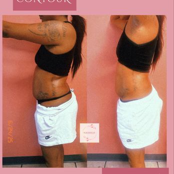 Bodybykye - Medical Spas Near Me - Sacramento, California Bodybykye - Medical Spas Near Me - Sacramento, California