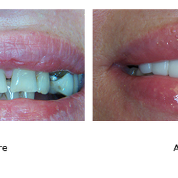 Dibling John B DDS - Oral Surgeons Near Me - Manalapan, New Jersey Dibling John B DDS - Oral Surgeons Near Me - Manalapan, New Jersey