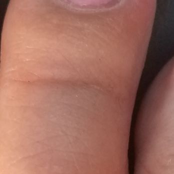 Palace Nails and Spa - My infected toenail from sides being cut and ripped out - Nail Salons Near Me - Peoria, Arizona Palace Nails and Spa - My infected toenail from sides being cut and ripped out - Nail Salons Near Me - Peoria, Arizona
