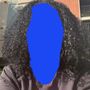 Follicles