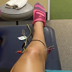 Kingwood Occupational & Physical Therapy - Dry needling for knee pain