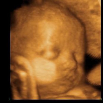 Baby Views - Pretty baby! - Ultrasound Imaging Centers Near Me - Little Rock, Arkansas Baby Views - Pretty baby! - Ultrasound Imaging Centers Near Me - Little Rock, Arkansas