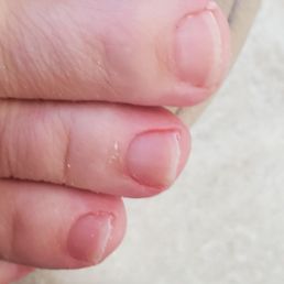 This is what my nails looked like after they were cut (hacked off) and filed!  Jagged, uneven.
