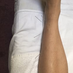 Taichi Family Health Acupucture