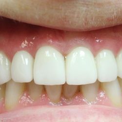 Karim Tadros, DDS - Veneers