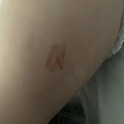 Clinica Medica Familiar - Needle slash