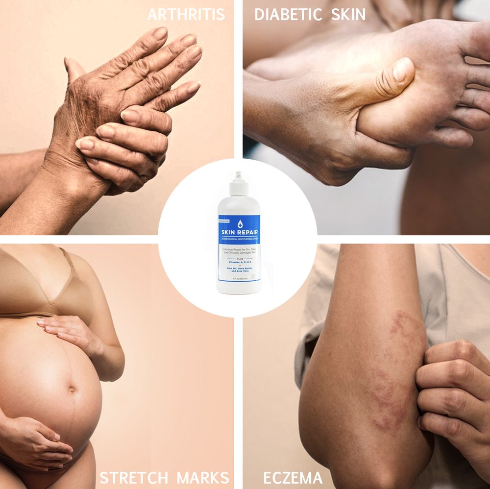 Skin Repair Rx Logo