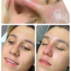 Bloom Wellness Spa - High frequency facial Hello beautiful people, 25% off going on this November. Please call 2547443990 to book appointments.