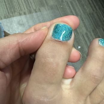 Nailed It Spa - Wounds from the nail tech digging out my cuticles & then buffing out what she irritated on my skin. - Nail Salons Near Me - Fresno, California Nailed It Spa - Wounds from the nail tech digging out my cuticles & then buffing out what she irritated on my skin. - Nail Salons Near Me - Fresno, California