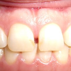 Shabbir Adenwalla DMD - 180 Orthodontics