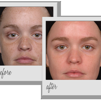 Skin by Denise - Skin Care Near Me - Oak Park, California Skin by Denise - Skin Care Near Me - Oak Park, California