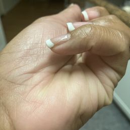 Pinky finger "gel polish " has chipped off. Pinky finger "gel polish " has chipped off.