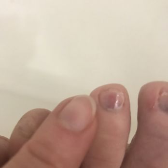 Lily Diamond Nails - Comparison of my fingernail (same treatment: gel removal, trim, clear coat) vs the toe and showing how thin they made the toe nail. - Nail Technicians Near Me - Glendale, California