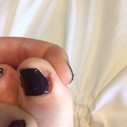 She ripped the skin off on the side of my toe! Left me bleeding and in pain. Not to mention the TERRIBLE paint job