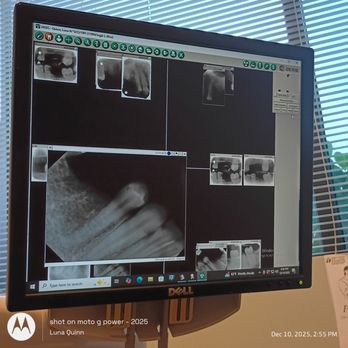 Elite Dentistry - Teeth photos awesomeness - General Dentistry Near Me - Vancouver, Washington