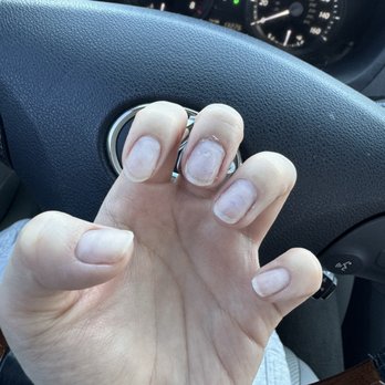 Peerage Nail Spa - I had a soak off too but you can see the acrylic residue in my nail beds. - Nail Salons Near Me - San Jose, California Peerage Nail Spa - I had a soak off too but you can see the acrylic residue in my nail beds. - Nail Salons Near Me - San Jose, California
