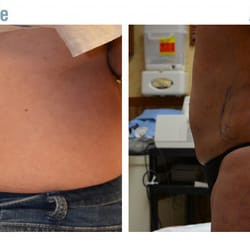 Advanced Therapeutics - Cosmetic Surgery and Rejuvenation
