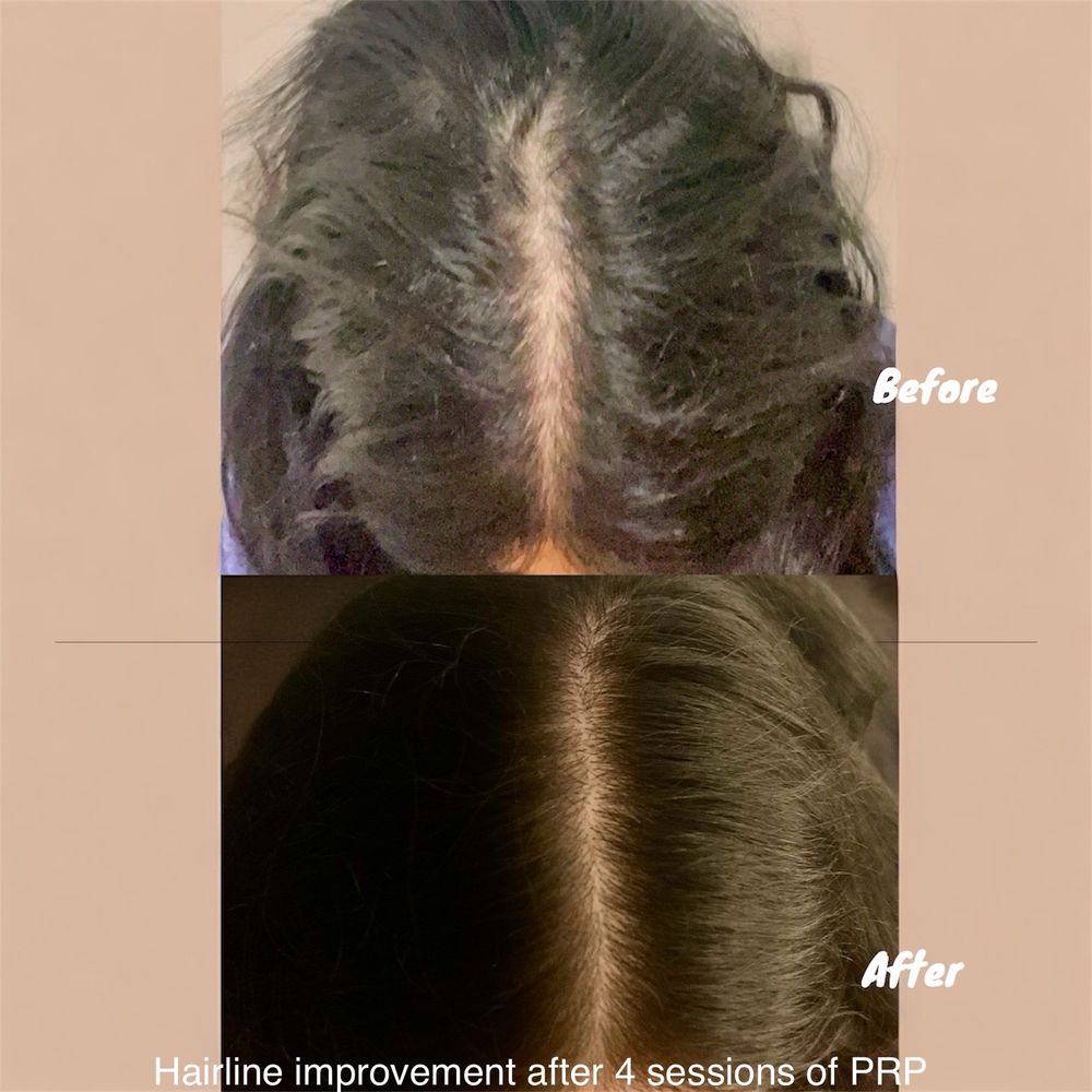 Beauty Within Botox And Filler Logo