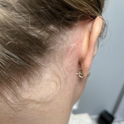 The Virginia Institute for Surgical Arts - Right ear