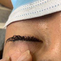 Beauty Utopia - Elsings "fix". Lashes are NOT supposed to touch eyelid. Caused infection.