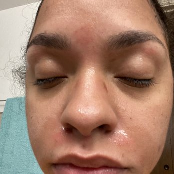 Nails and More - Eyebrow, as well as upper lip burn - Nail Salons Near Me - Tucson, Arizona Nails and More - Eyebrow, as well as upper lip burn - Nail Salons Near Me - Tucson, Arizona