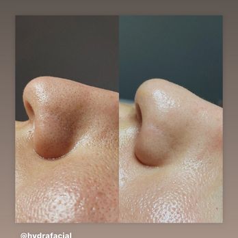 Spa Piel - Skin Care Near Me - La Mesa, California