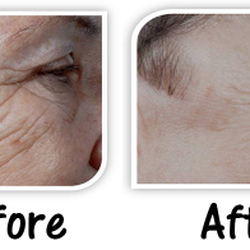 BeauVisage Esthetics
