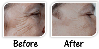 BeauVisage Esthetics Logo