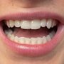 Smiley Dental - Beverly