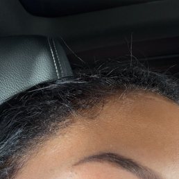 Took too much hair off Took too much hair off