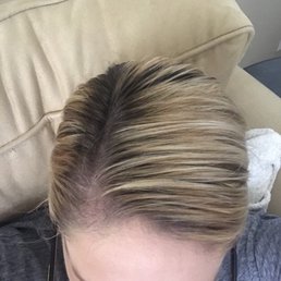 Before Before