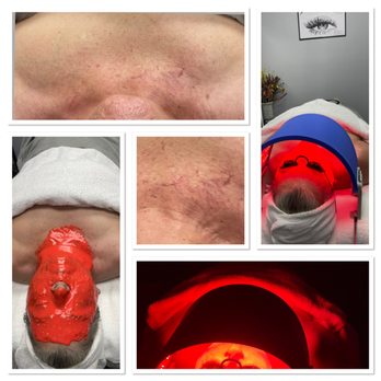 Christina Studio and Spa - LED and collagen therapy - Skin Care Near Me - Beckley, West Virginia