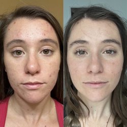 Nami Skin Care & Electrolysis