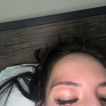 RT Nails & Spa - It is swollen and burned my skin real bad - Nail Salons Near Me - Tucson, Arizona