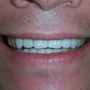 The Smile Lounge