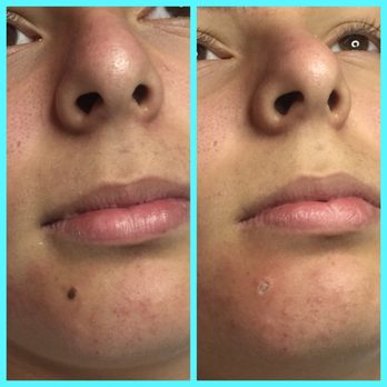 Upper Layers Skin Care - Skin Care Near Me - Hawthorne, California Upper Layers Skin Care - Skin Care Near Me - Hawthorne, California