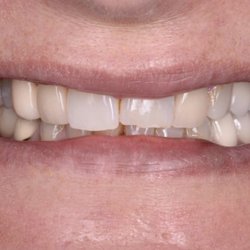 BrightCraft Dental & Laser - Before: discolored teeth
swipe to see the after